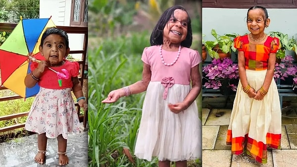 Hindistan'ın Kerala eyaletine bağlı Wayanad bölgesinde yaşayan Aizza Akhil'in hikâyesi, henüz 6 aylık bir bebekken ailesinin fark ettiği küçük bir değişimle başladı.
