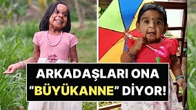 4 Milyonda Bir Görülen Hastalıkla Mücadele Ediyor: 6 Yaşındaki Aizza'ya Okulda "Büyükanne" Diyorlar