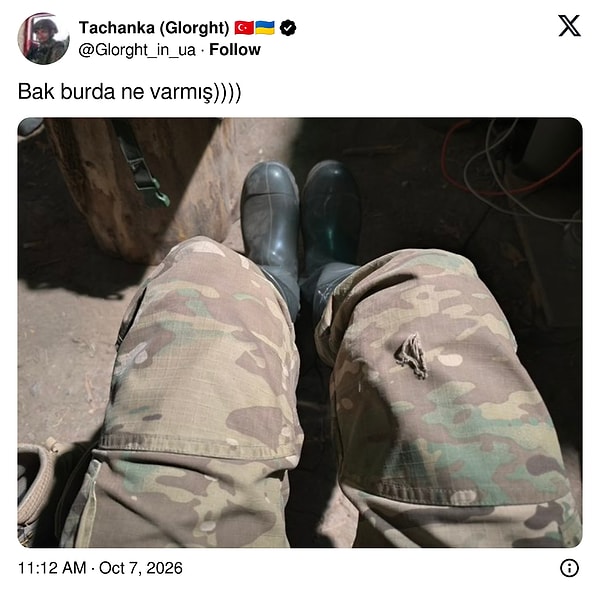 Ukrayna ordusunda görev yaptığını belirten Tachanka, kendi bacaklarının fotoğrafıyla yanıt verdi