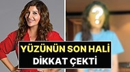 Verdiği 20 Kiloyla Gündem Olmuştu: Şebnem Bozoklu'nun Yüzündeki Değişim Dikkat Çekti!