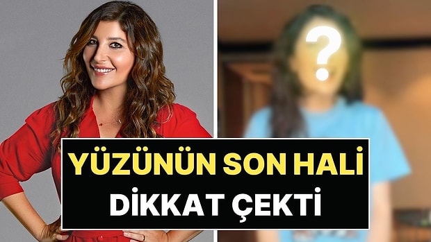 Verdiği 20 Kiloyla Gündem Olmuştu: Şebnem Bozoklu'nun Yüzündeki Değişim Dikkat Çekti!