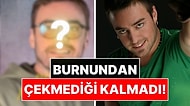 Burnundan Çekmediği Kalmadı: 13 Kez Ameliyat Olan Murat Dalkılıç'ın Son Hali Gündem Oldu
