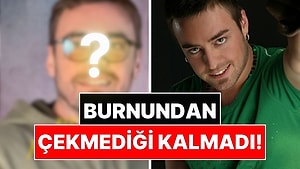 Burnundan Çekmediği Kalmadı: 13 Kez Ameliyat Olan Murat Dalkılıç'ın Son Hali Gündem Oldu