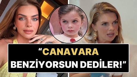Pelin Karahan Çocukken Yaşadığı Kazayı ve Ardından Yaşadığı Travmayı Anlattı!