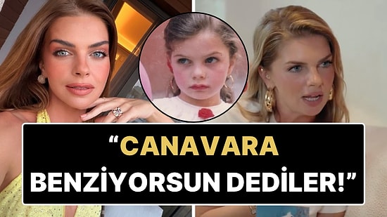 Pelin Karahan Çocukken Yaşadığı Kazayı ve Ardından Yaşadığı Travmayı Anlattı!
