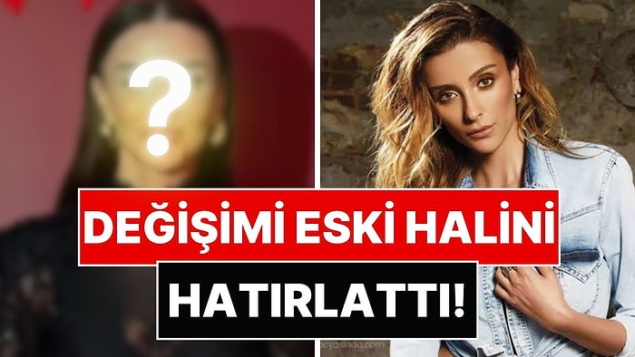Özge Ulusoy'un Yüzünün Son Hali Gündem Oldu: Değişimi Eski Halini Hatırlattı!