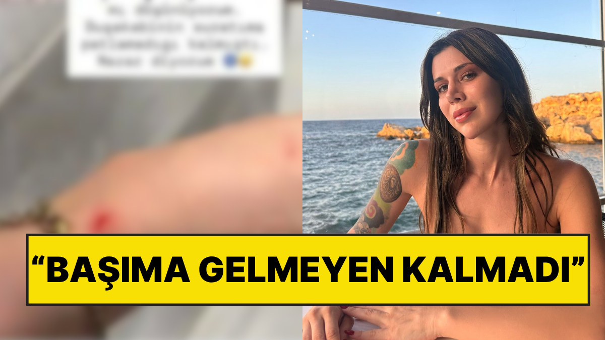Ateşi 40'ı Bulmuştu: Survivor Şampiyonu Nefise Karatay Bu Kez Evinde Yaşadığı Kazayla Sevenlerini Korkuttu!