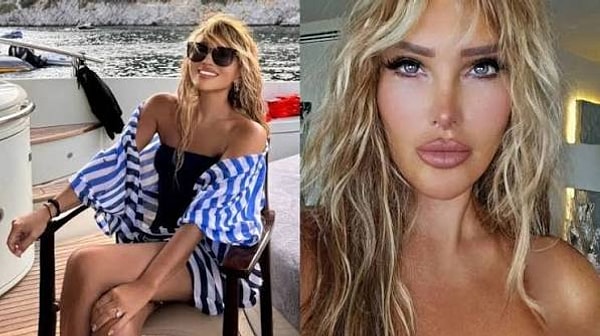 Seren Serengil, bu kez özel hayatından çok sağlığıyla ilgili anlattıklarıyla gündemde.