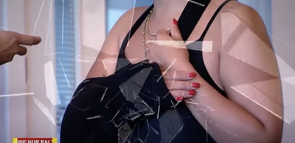 Elinde 15 dikiş olduğunu belirten talihsiz kadın, baş parmağında hissizlik olduğunu ve otel yönetiminden şikayetçi olduğunu ekledi.