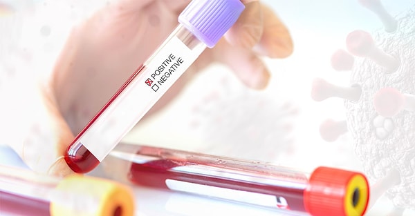 Ülkemizde genç yaş grubundaki bu artışta en önemli etkenin, bu yaş grubundaki gençlerde üreme sağlığı konusundaki eğitim eksikliği olduğunu vurgulayan Dr. Derin, “Türkiye'de benim ulaşabildiğim kaynaklara göre, 1974 ila 2023 yılları arasında okullarda üreme sağlığı konusunda eğitim var. Ancak 2003 yılından sonra bu eğitimlerin kesildiğine dair yayınlar var. Lise ya da üniversitelerde bu tip eğitimlere ihtiyaç olduğu aşikâr." ifadelerini kullandı.